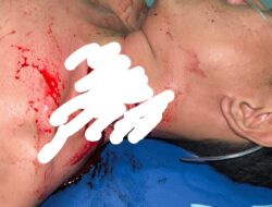Pengendara Jadi korban Begal di Mata Kucing Kecamatan Sekupang 