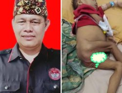 Warga Dusun Congkanan Desa Bayas Jaya Kurang Gizi ketua setwil fpii lampung Angkat Bicara 